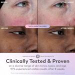 Olay Super Serum - Niacinamide, Vitamin C & E, Collagen Peptide, AHA - 5-in-1 Skin Care Benefits for Face - Healthy Glow, Brightening, Hydrating, Smoothing, Firming, Evens Tone, Anti-Aging, 1.0 Oz - Image 6