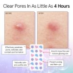 grace & stella Award Winning Pore Strip - Pimple Patches for Face - Hydrocolloid Acne Patches - Absorbs Zits, Reduces Redness - Cute Patches Dermatologist-Tested, Vegan (Multishape, 36 Count) - Image 4